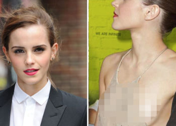 8 trapasů, které si Emma Watson za rámeček nedá! Kalhotky a bradavky? Žádný problém!