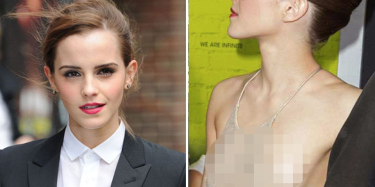 8 trapasů, které si Emma Watson za rámeček nedá! Kalhotky a bradavky? Žádný problém!