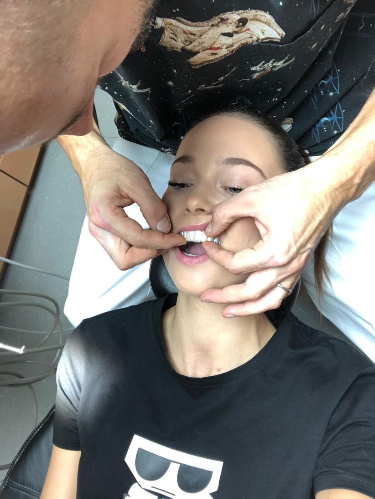 Lea Šteflíčková: Kamarádky mi závidí zuby, nedivím se jim