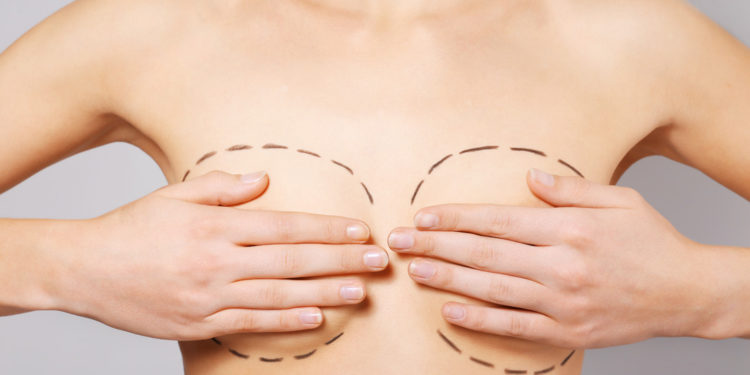 Drobná nedokonalost: Přednost nebo prokletí?